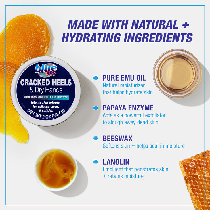 Cracked Heels & Dry Hands (2 oz.)