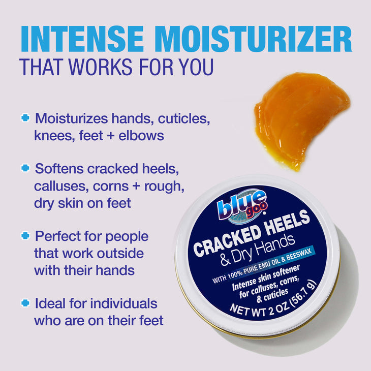 Cracked Heels & Dry Hands (2 oz.)
