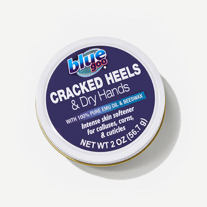 Cracked Heels & Dry Hands (2 oz.)