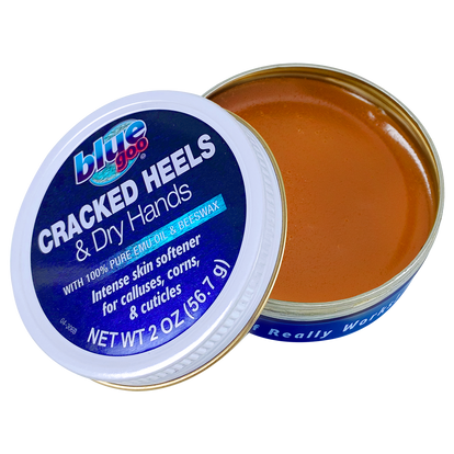 Cracked Heels & Dry Hands (2 oz.)