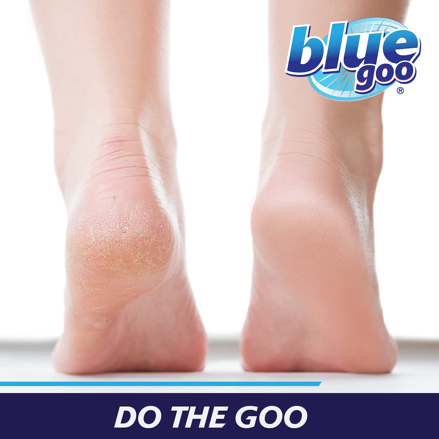 Blue Goo in Foot Care 